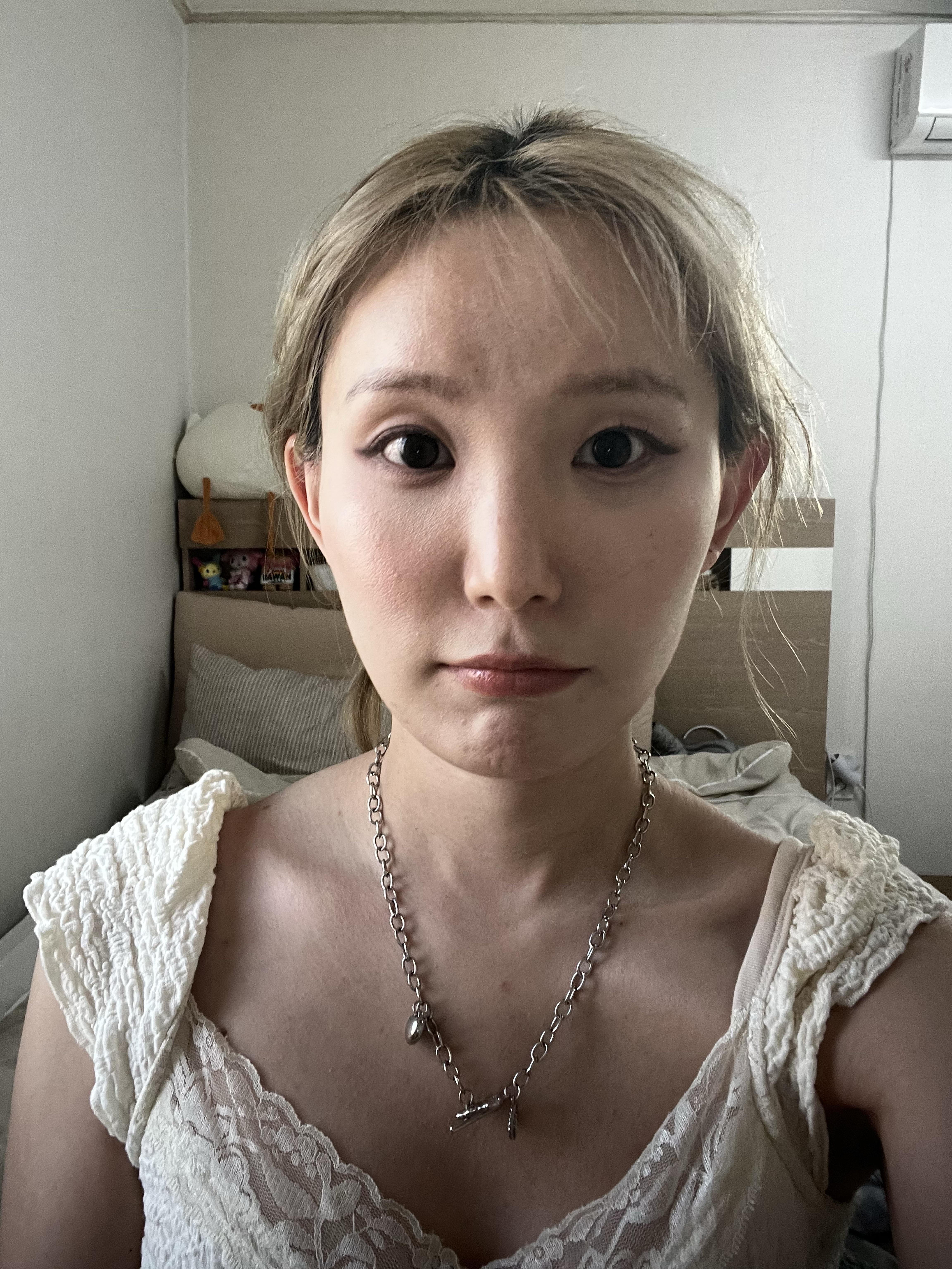 後