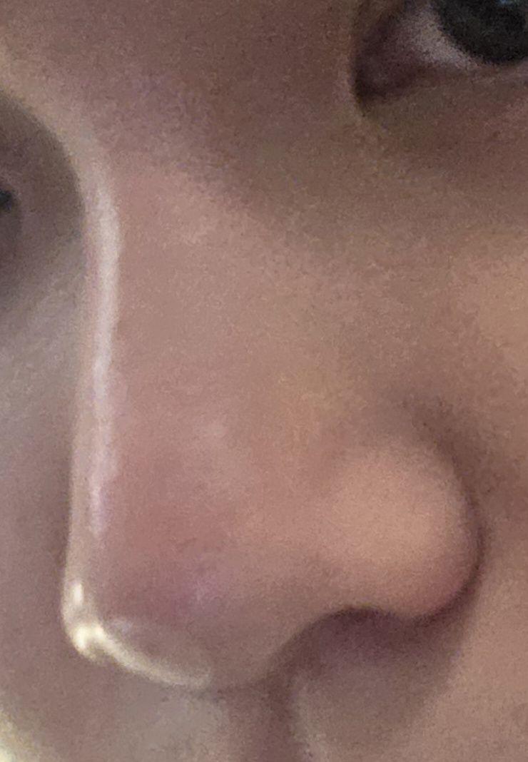 後