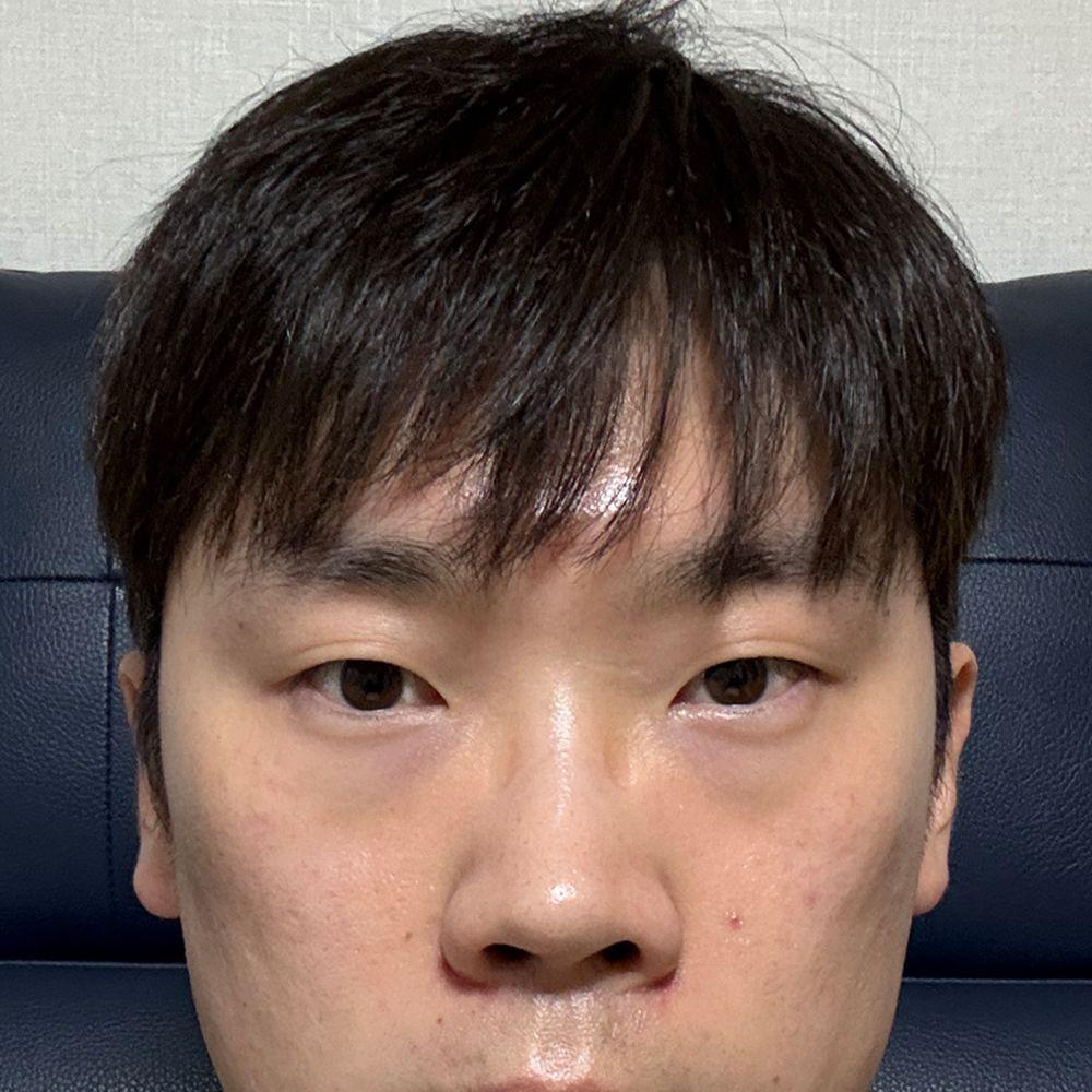 後
