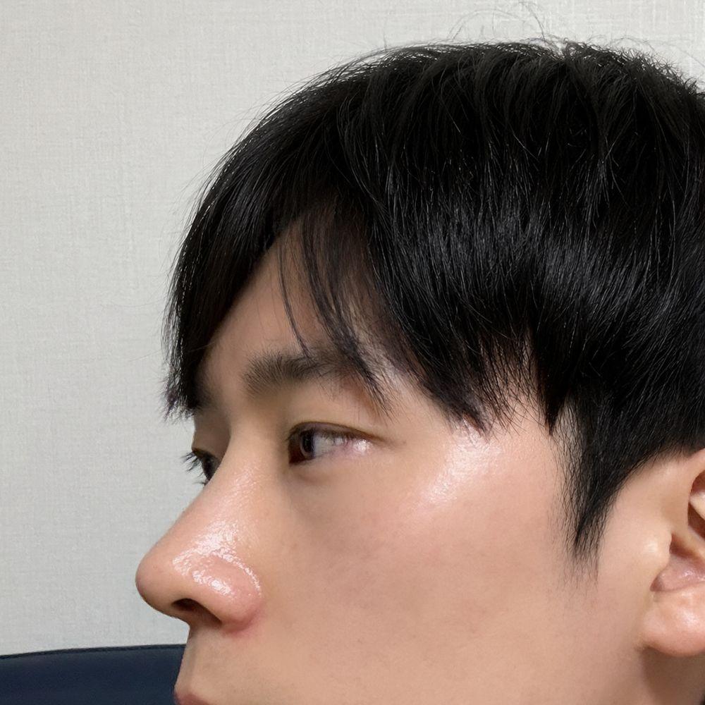 後