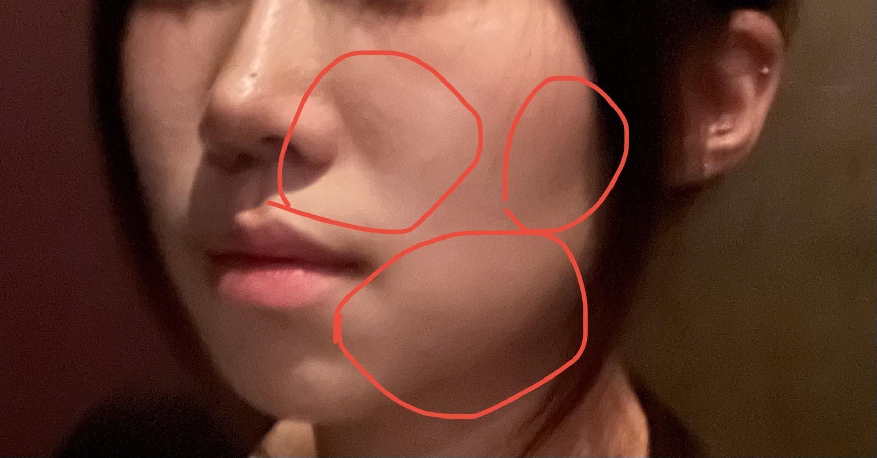後