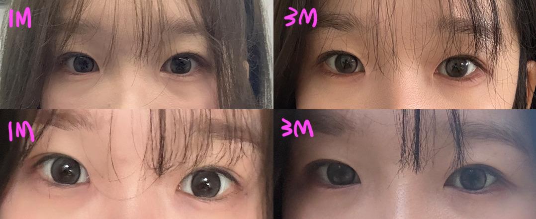 后