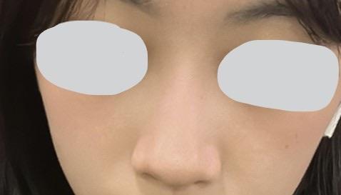 後