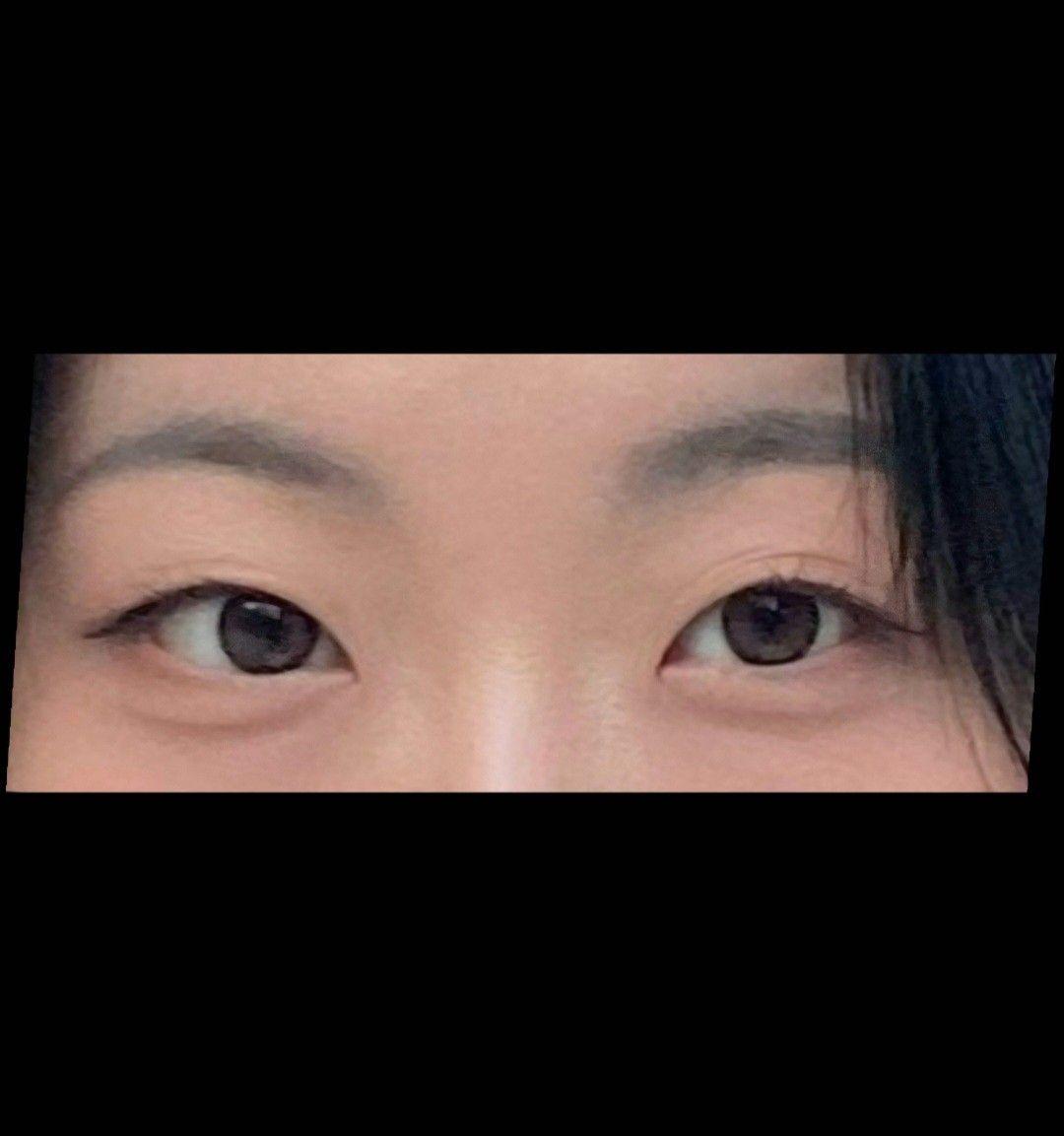 後