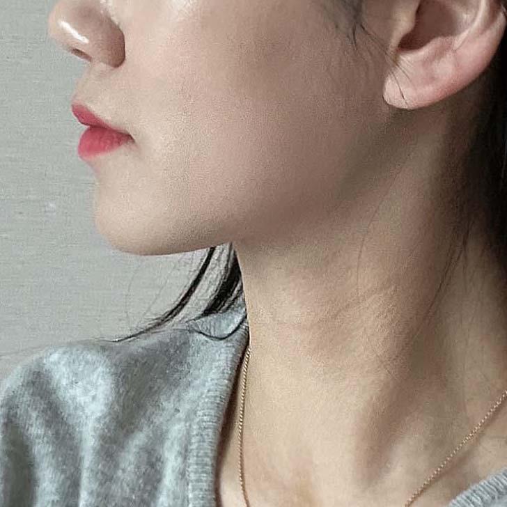 後