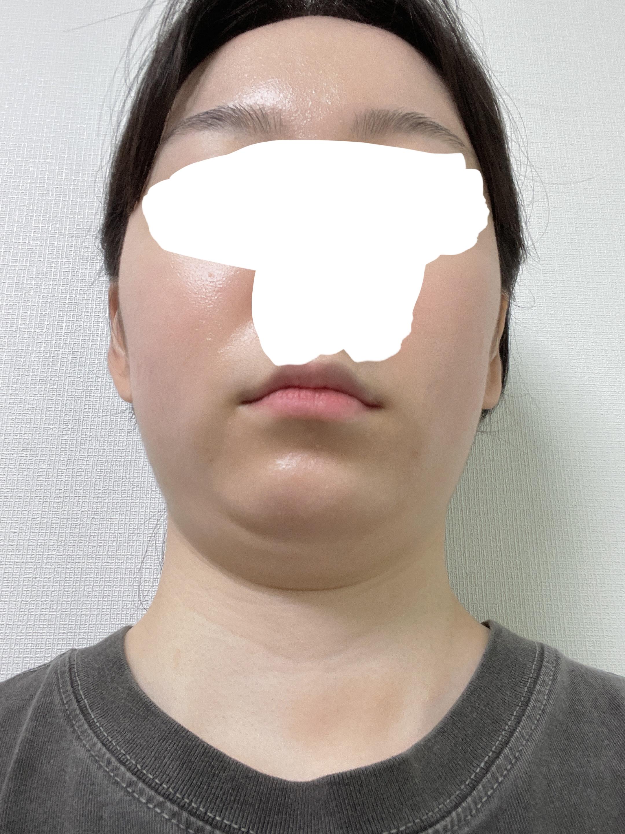 後