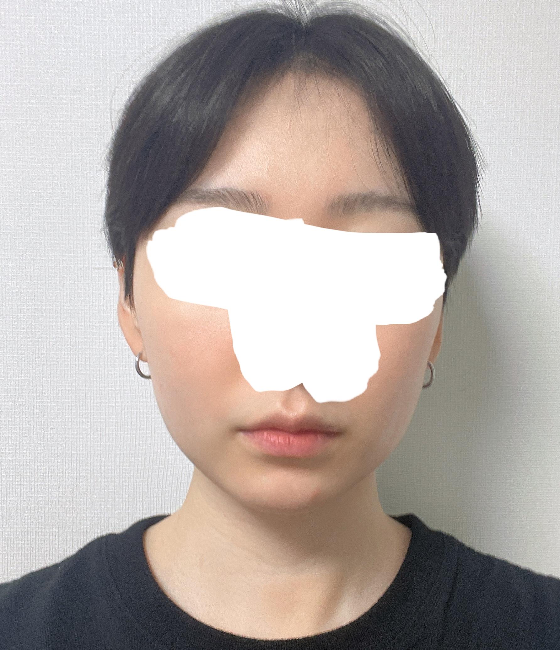 後