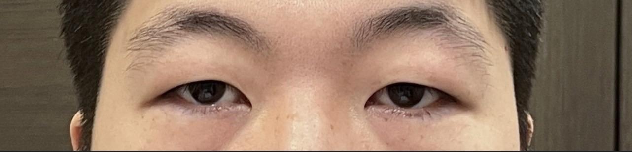 後