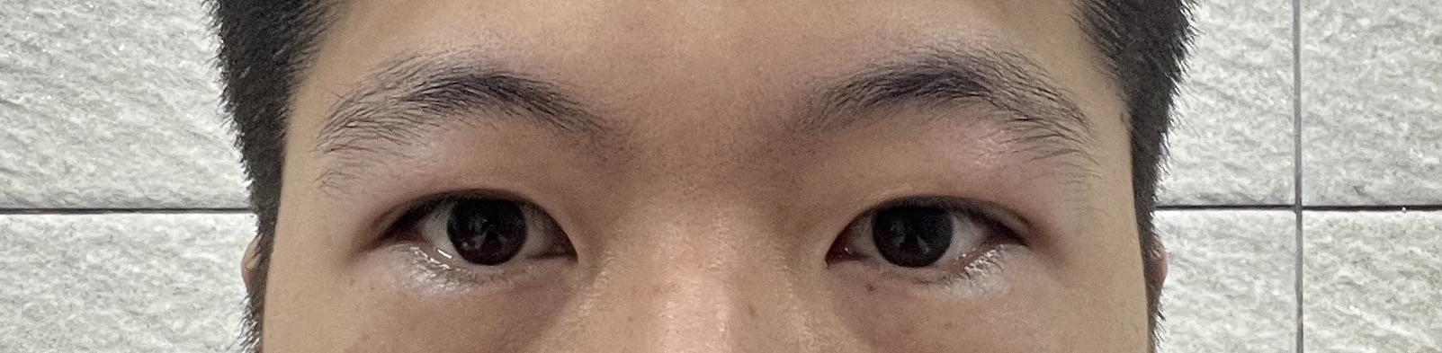 後