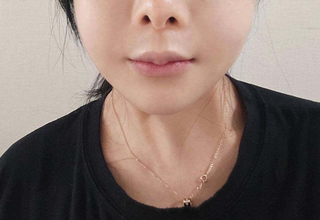 後