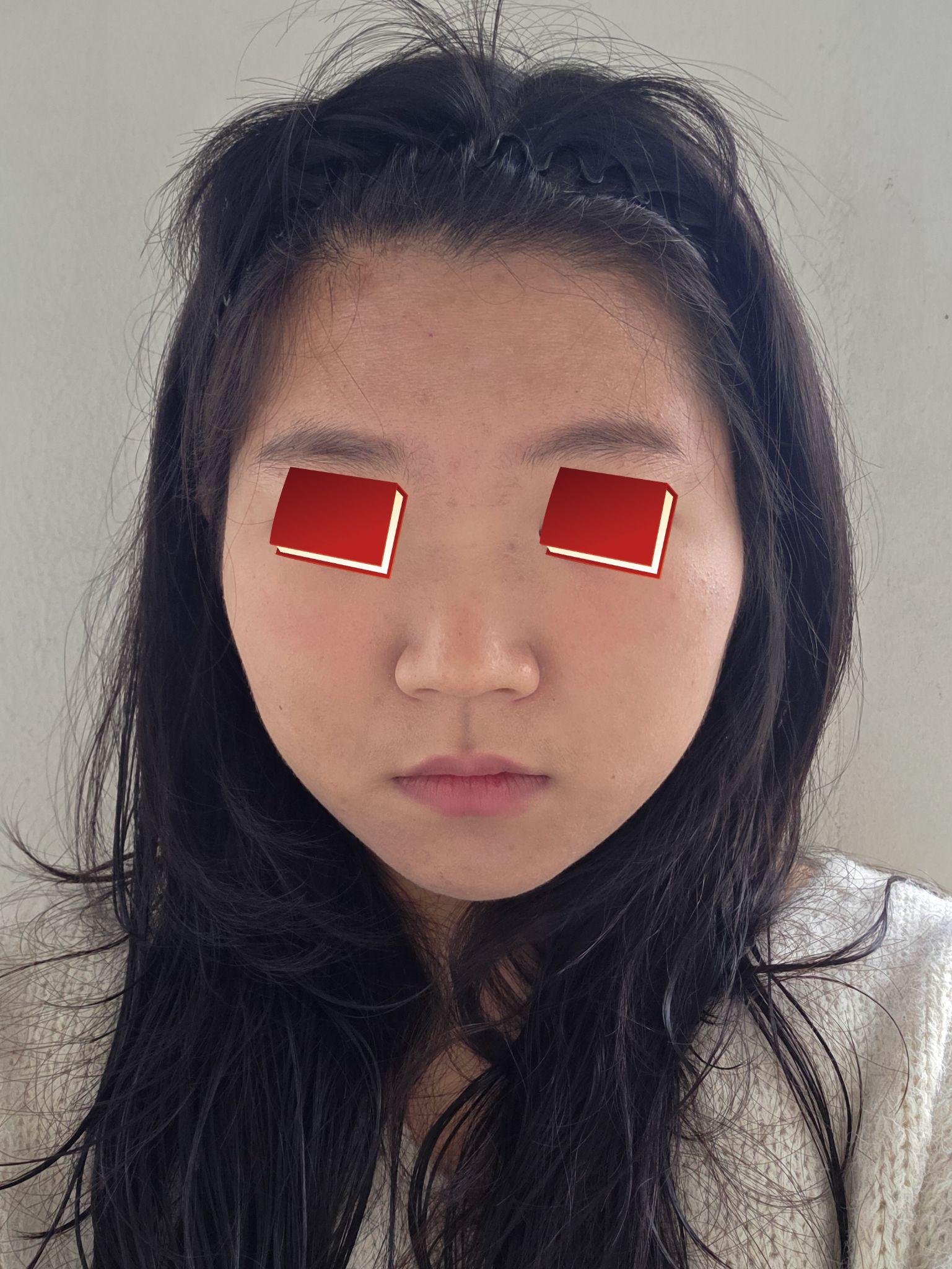 後