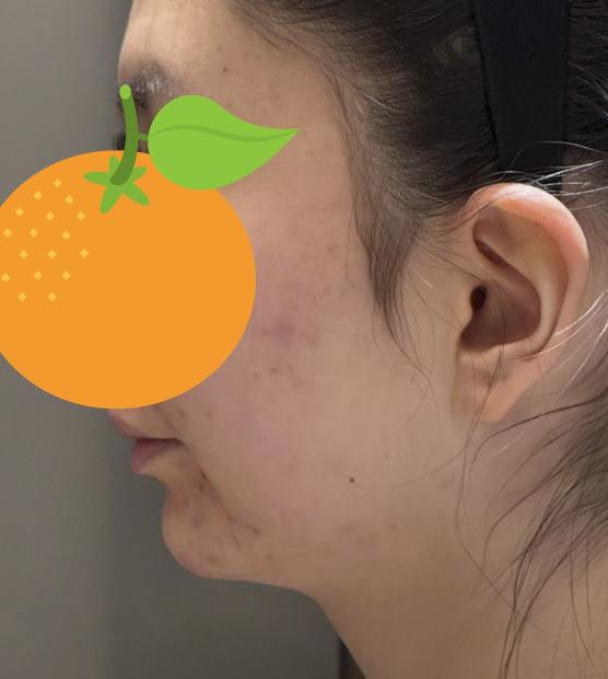 前