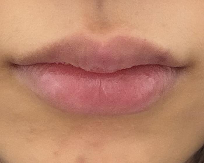 後