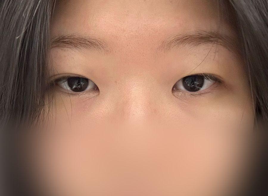 後