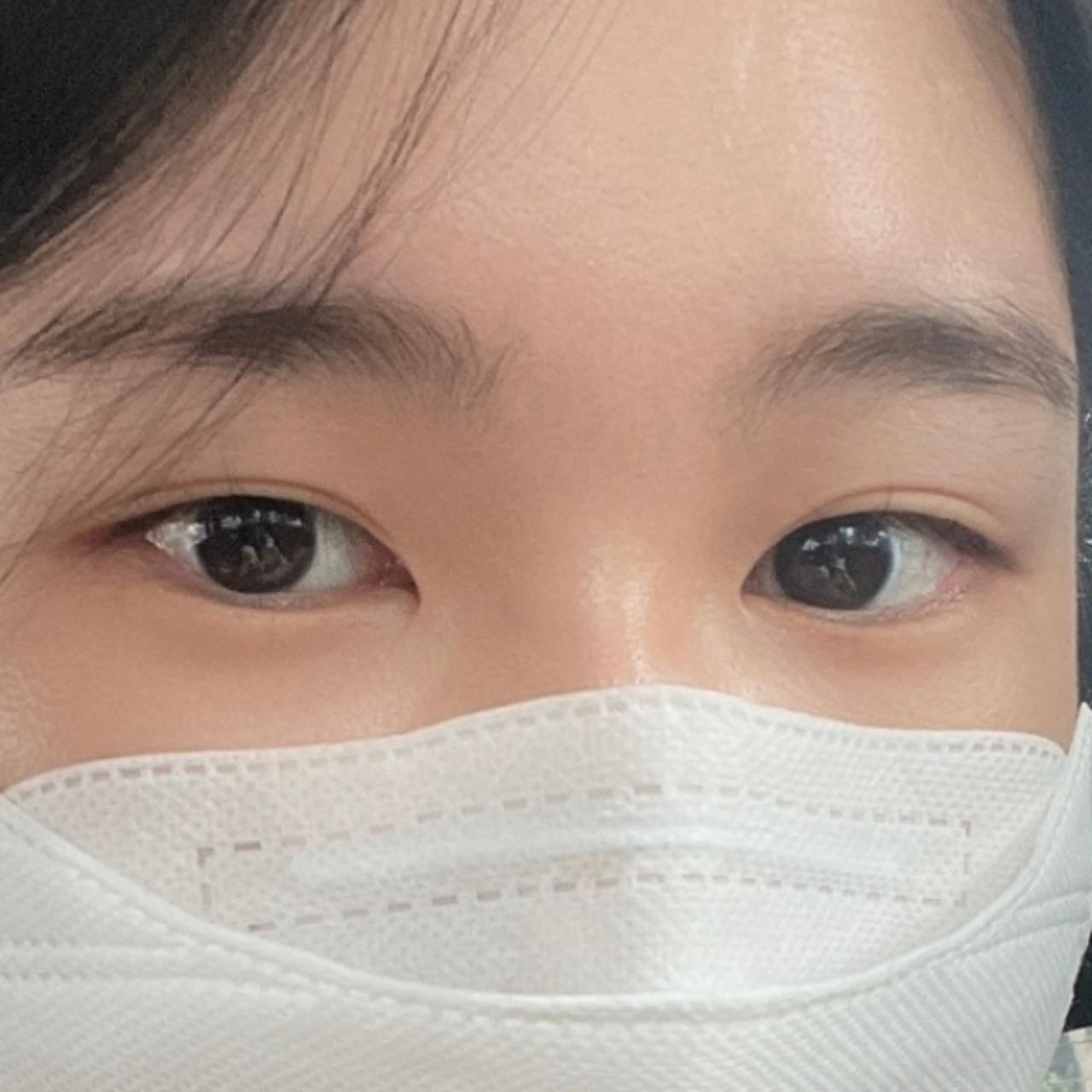 後