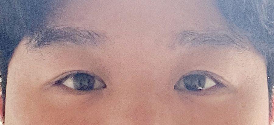 後