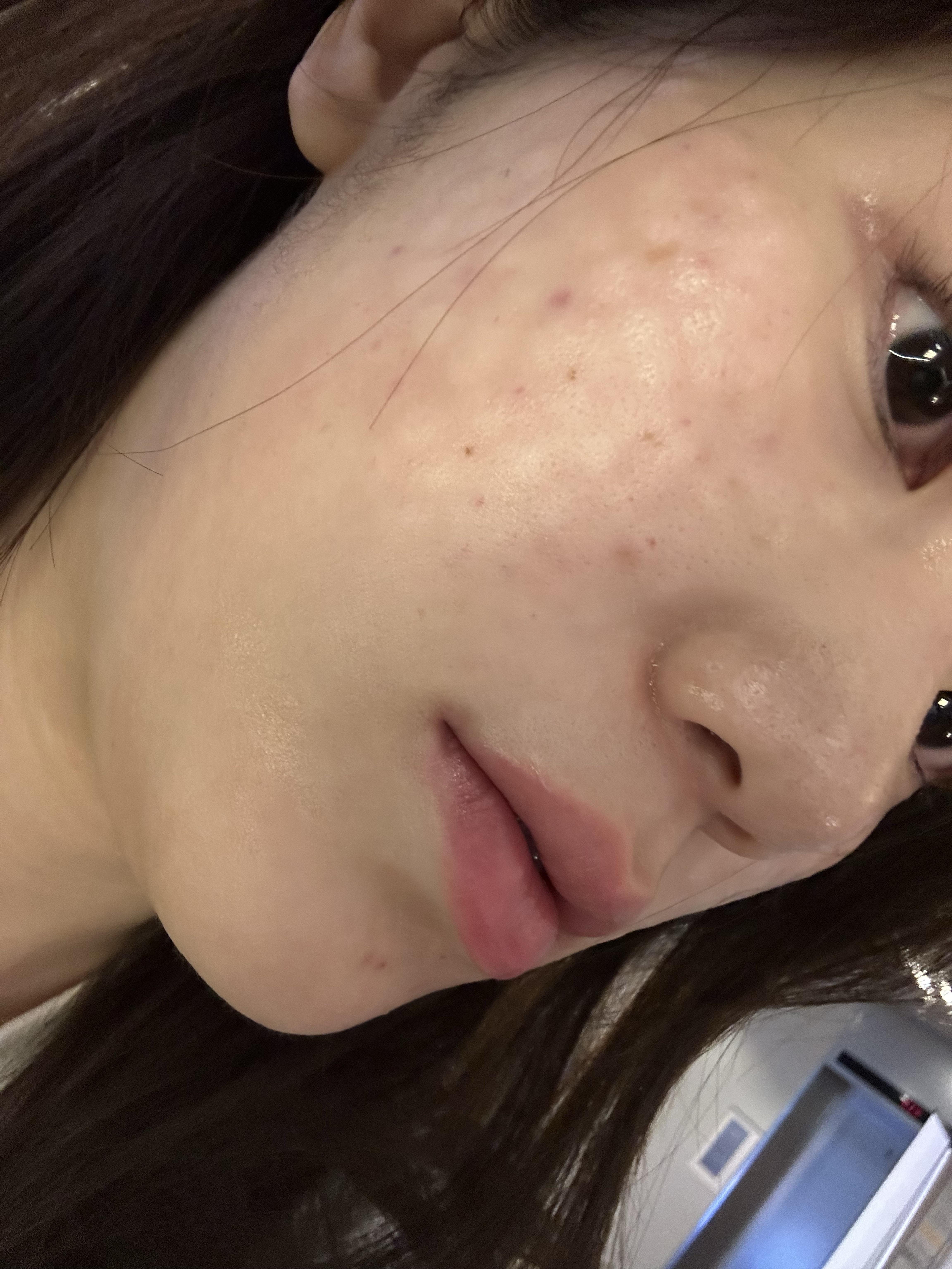後