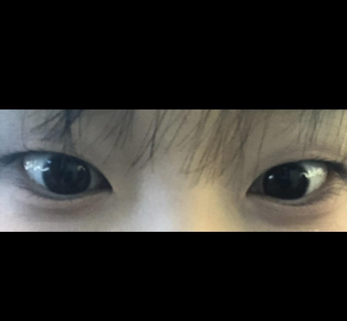 後