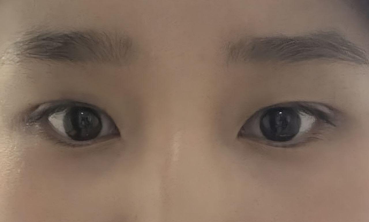 後
