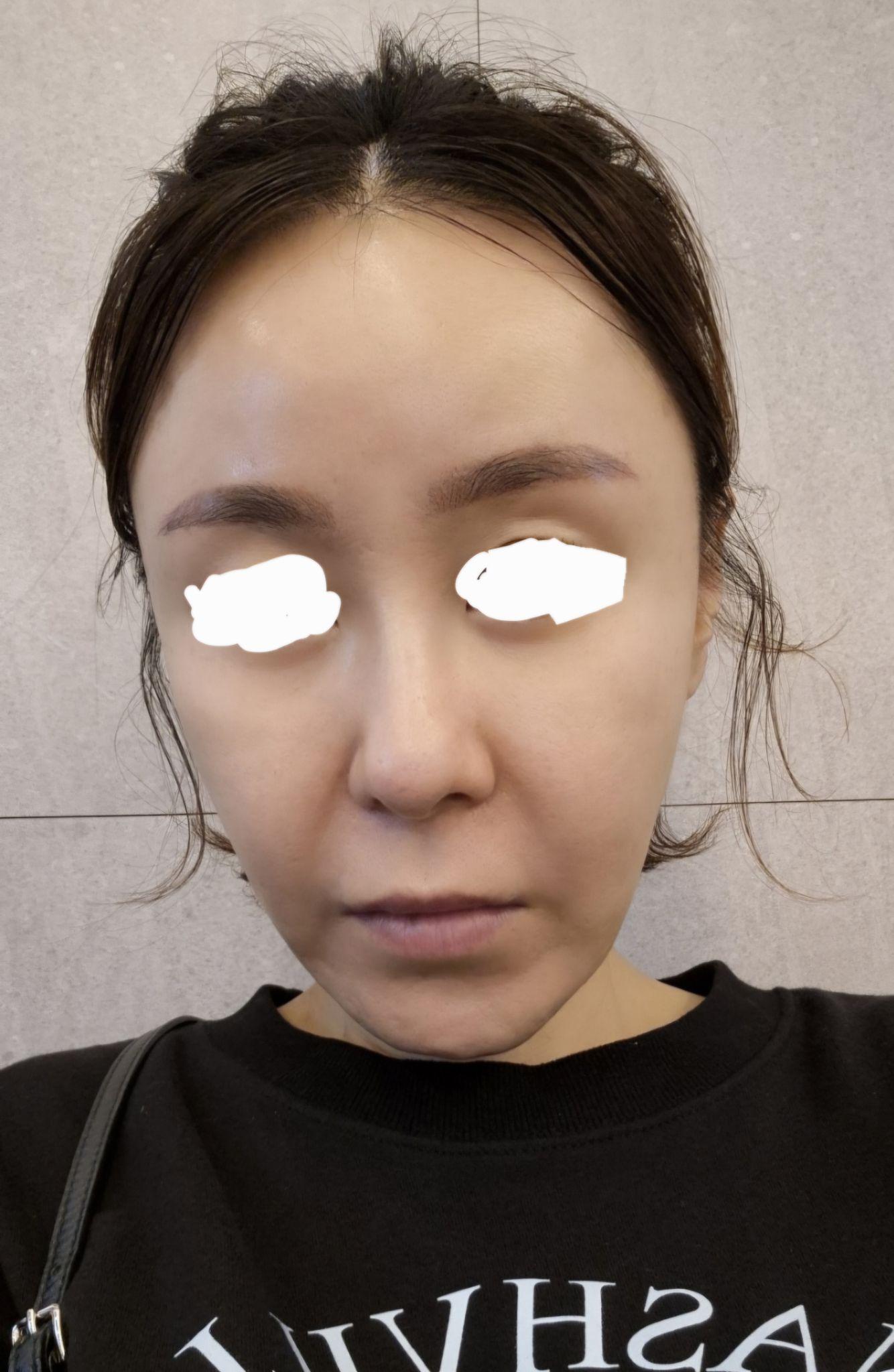 後