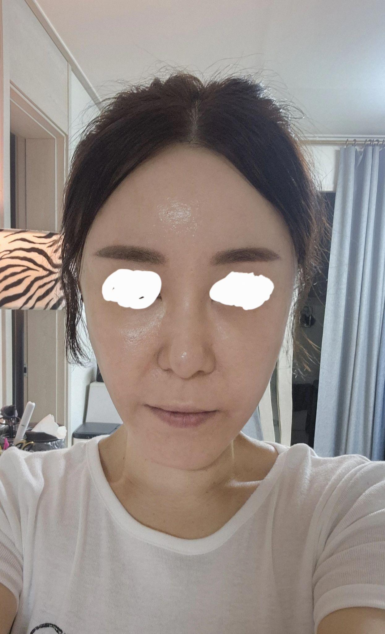 後