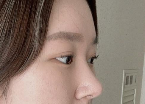 後