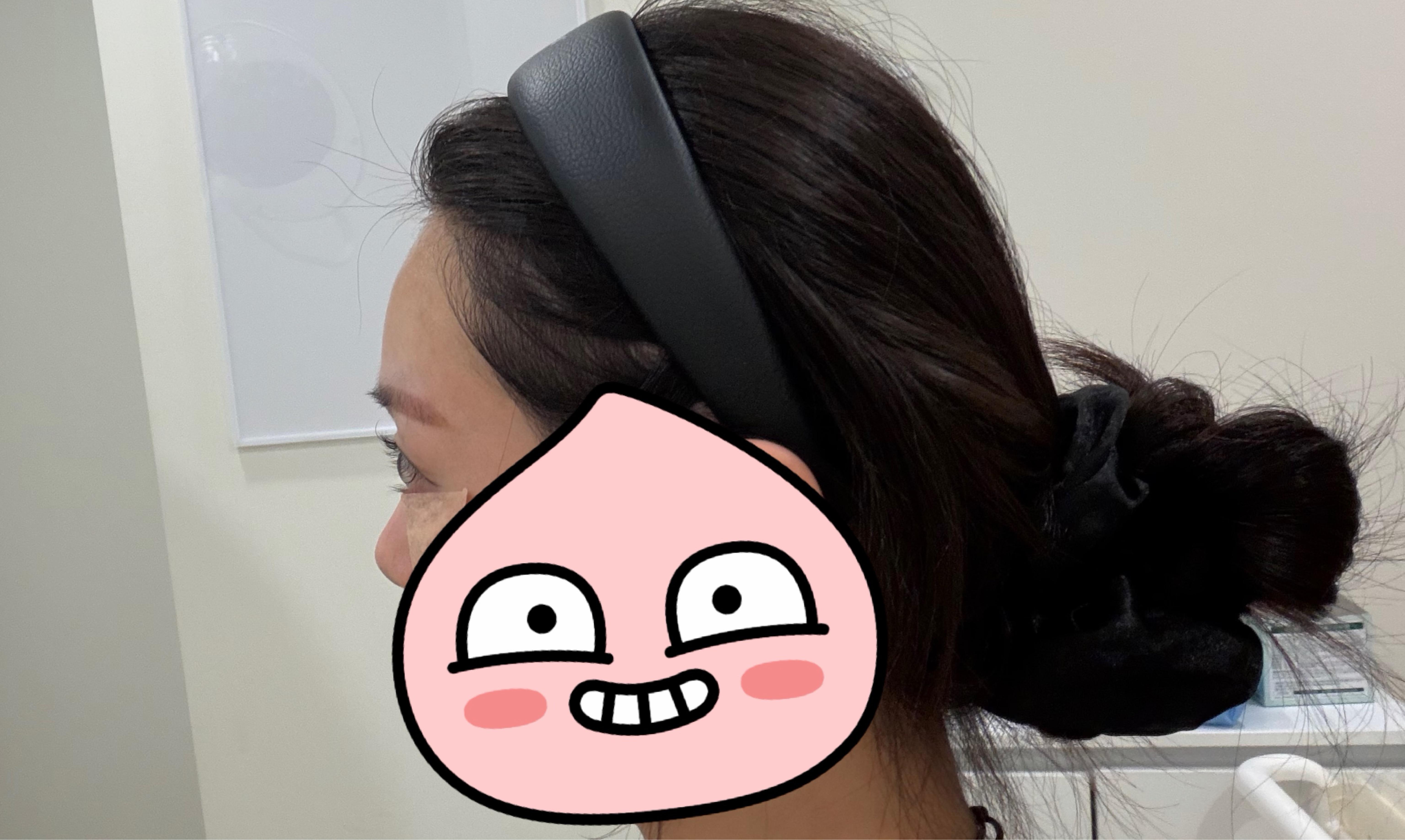 Before