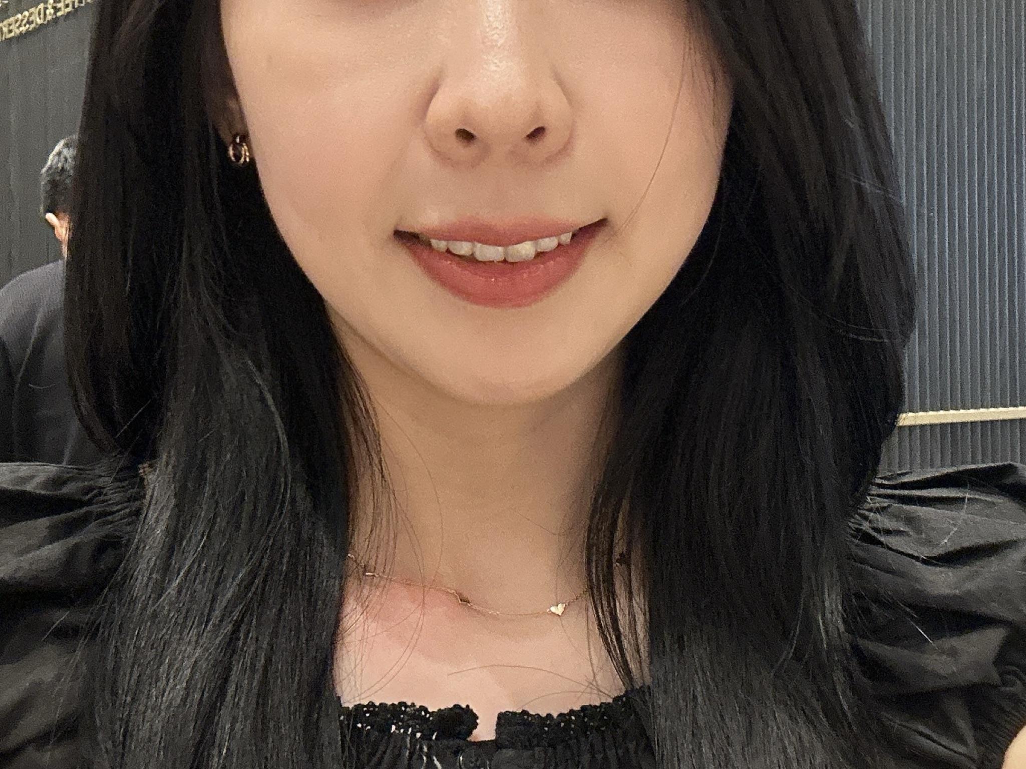 後
