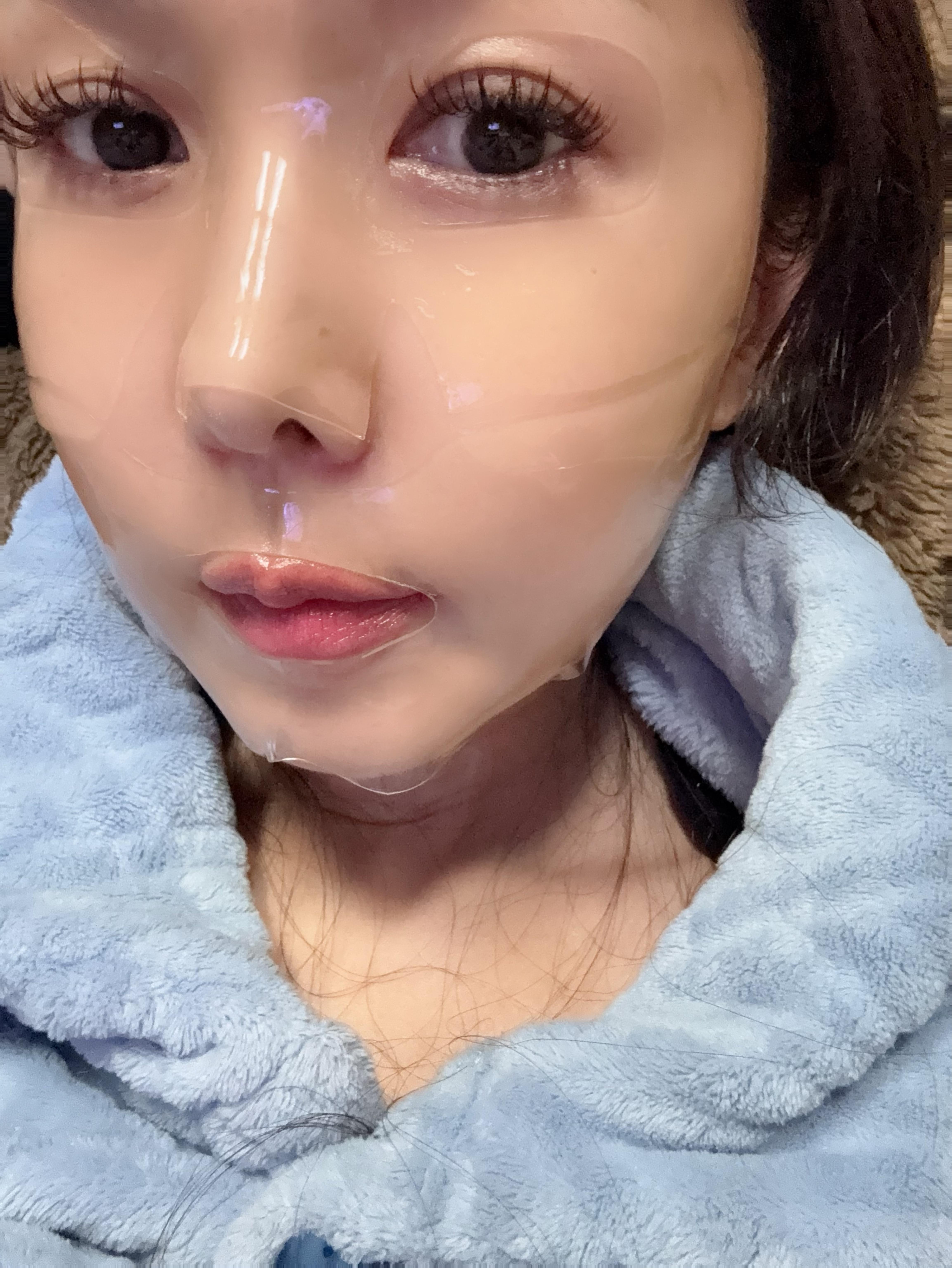 後