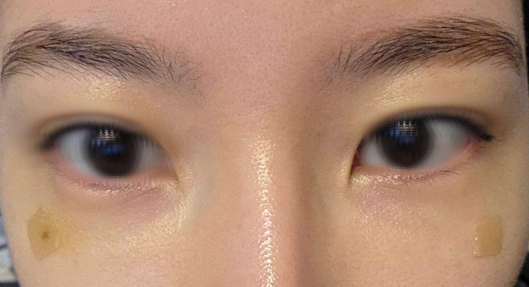后