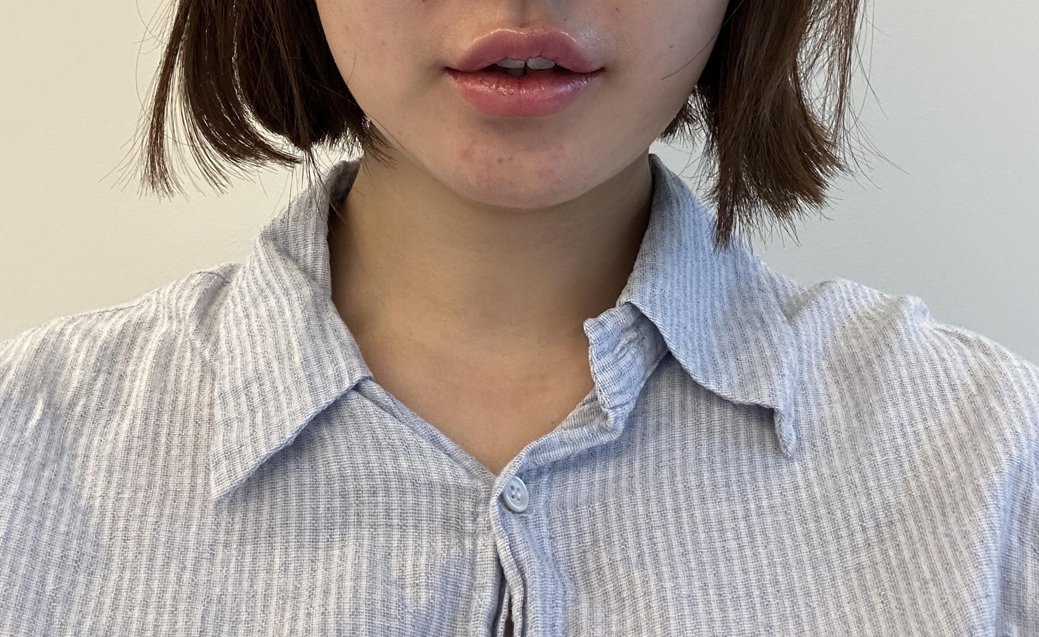 後