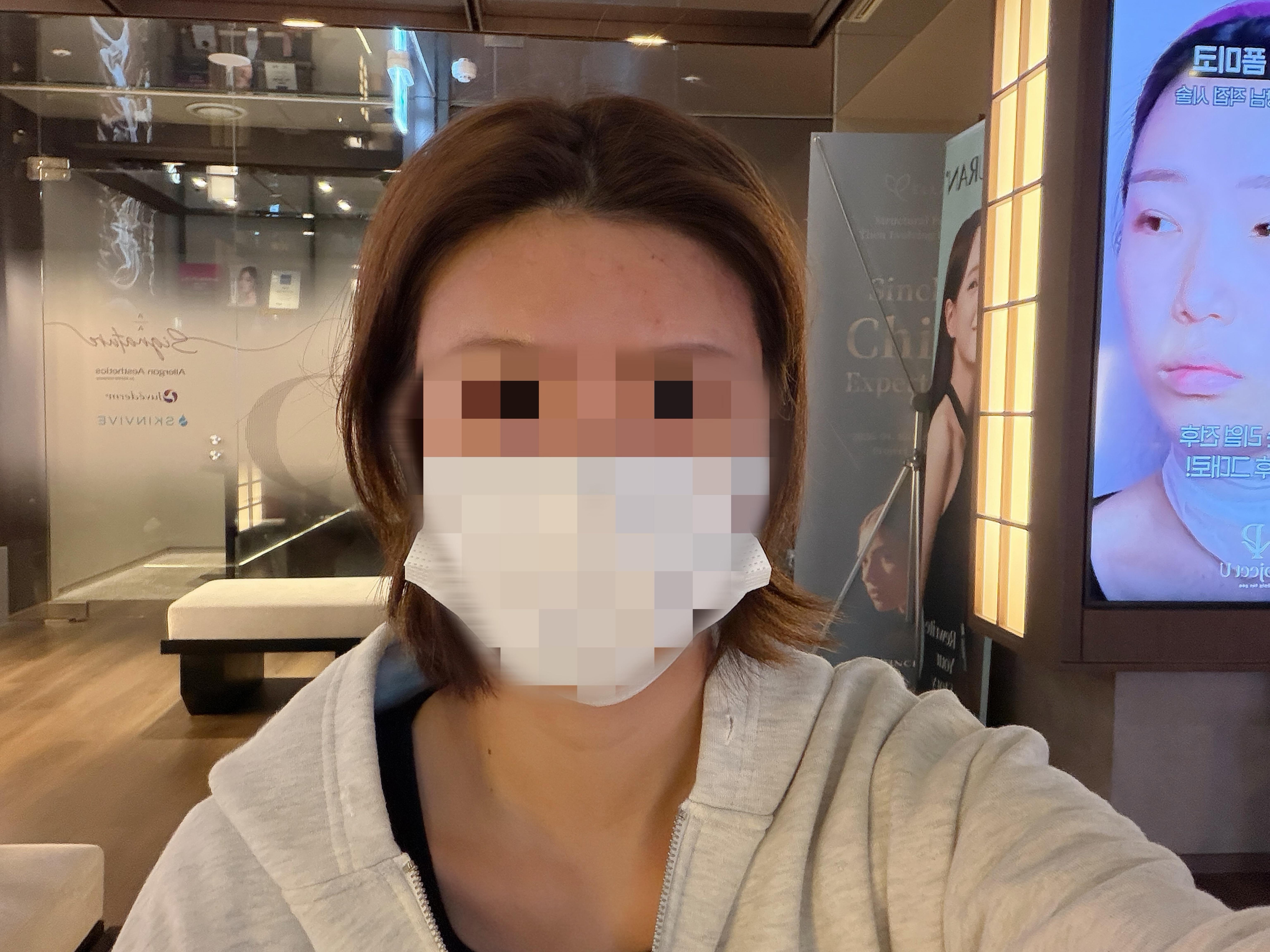 後