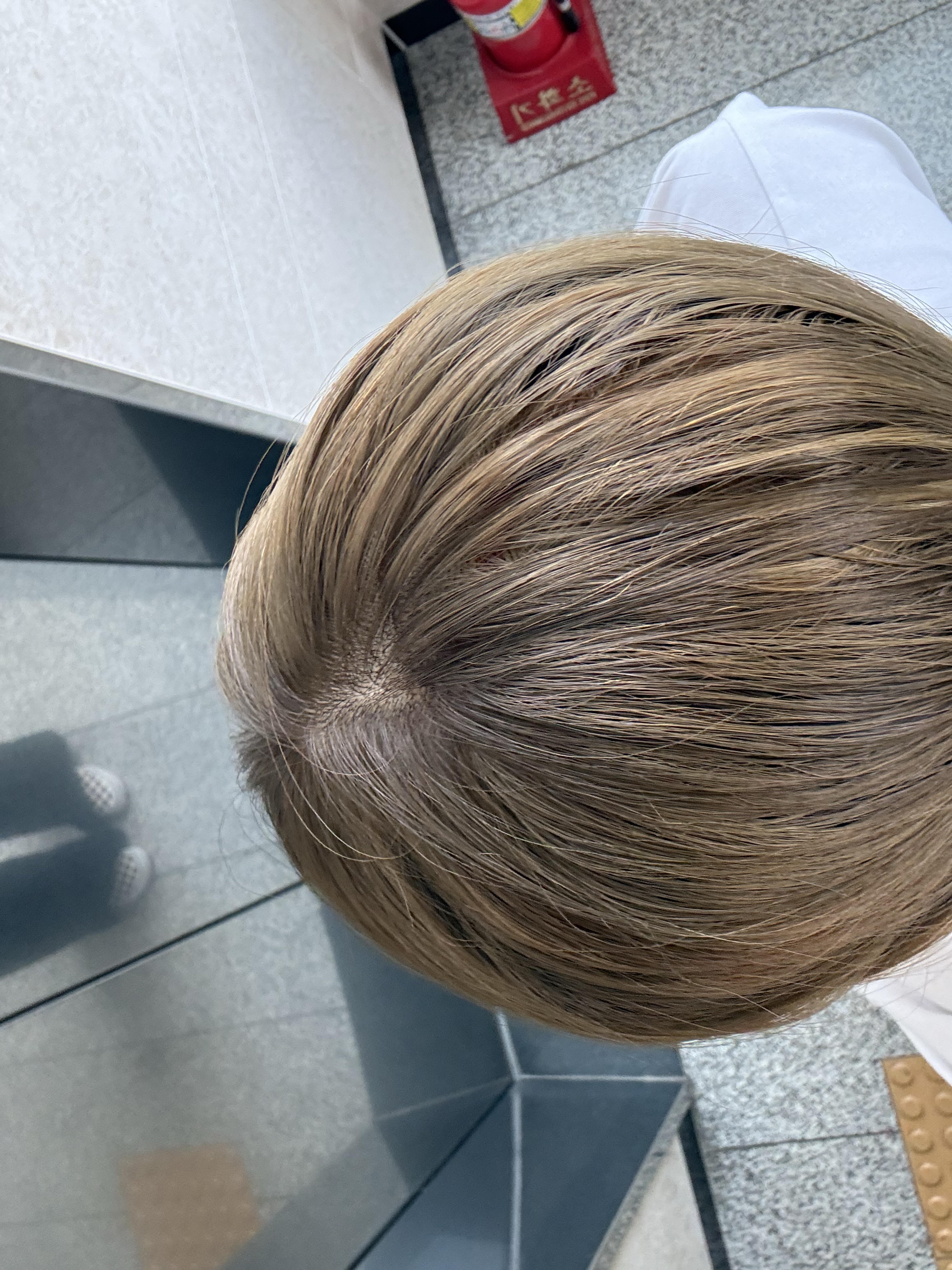 后