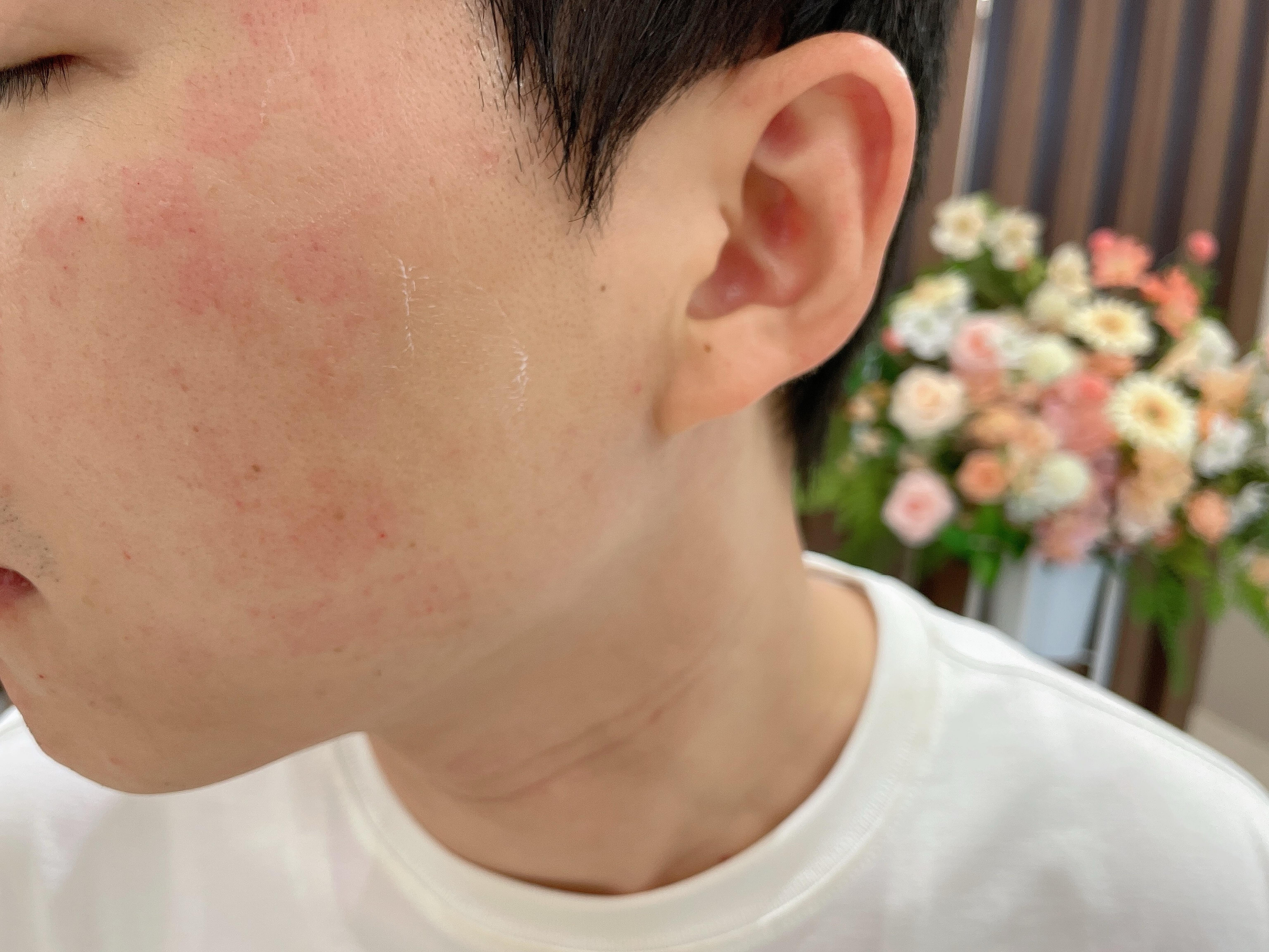 後