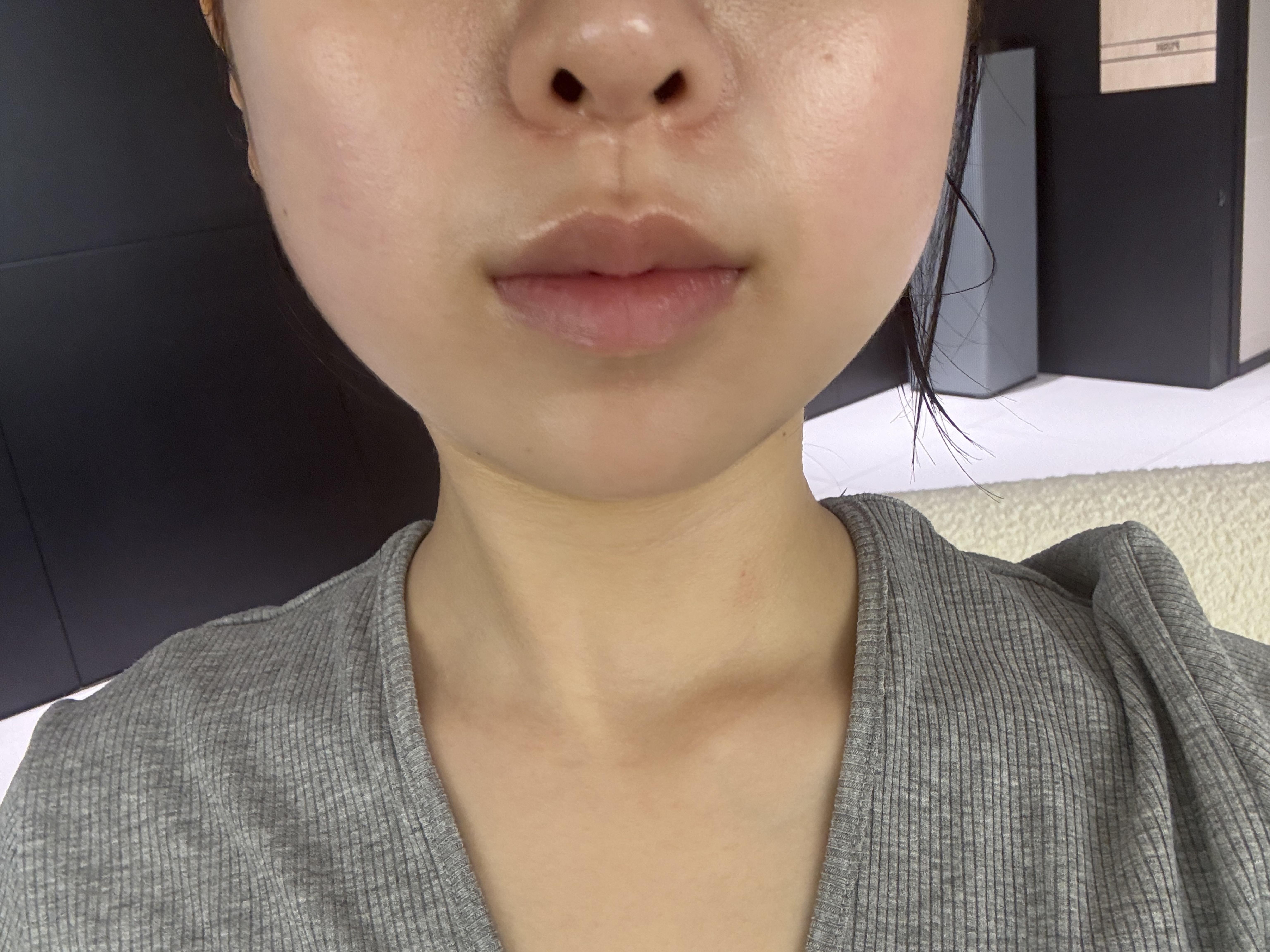 後