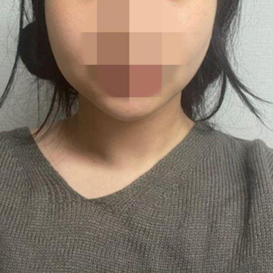 前