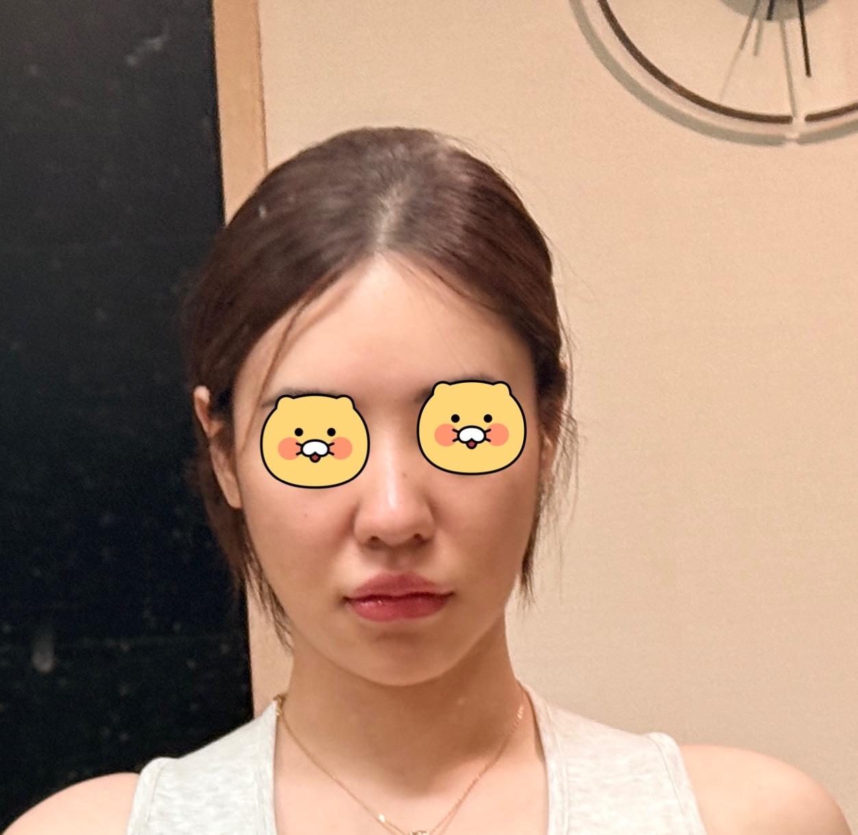 前