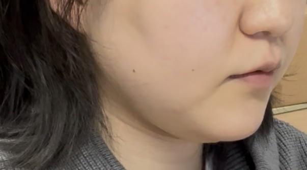 前
