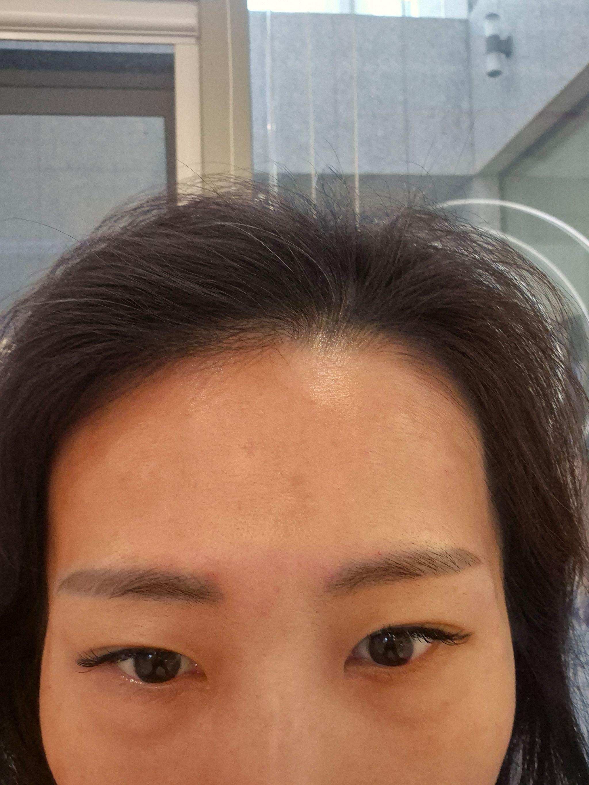 后