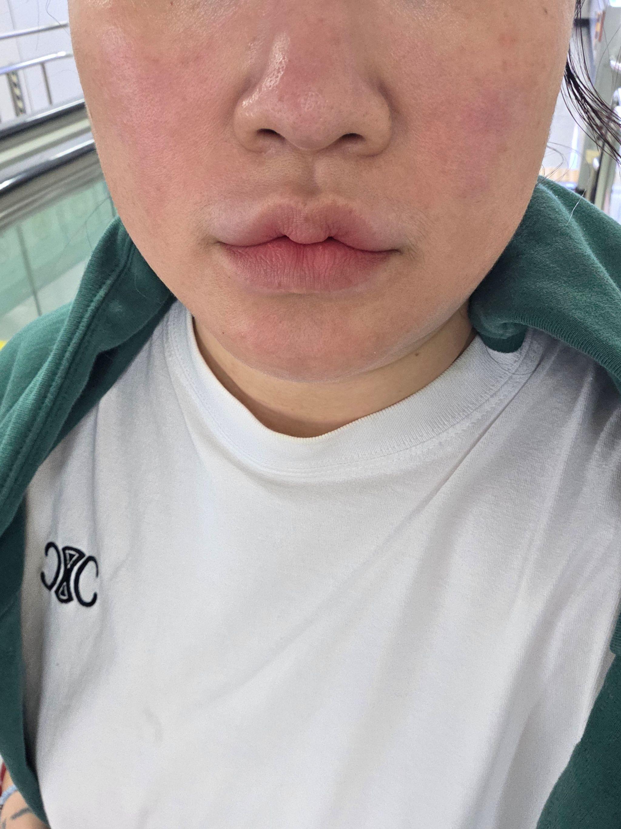 後