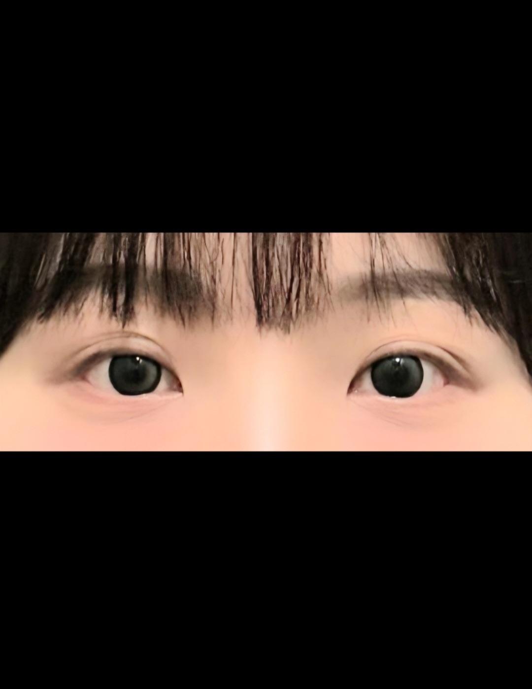 後