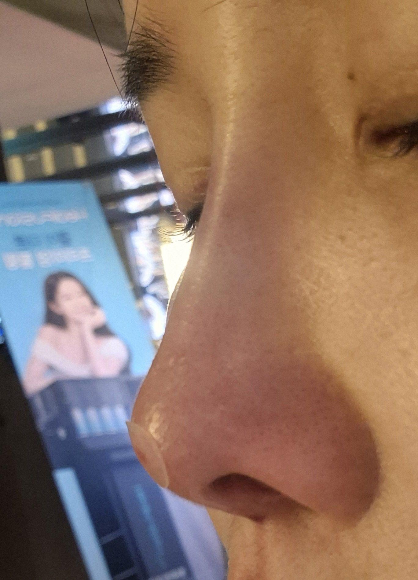 後