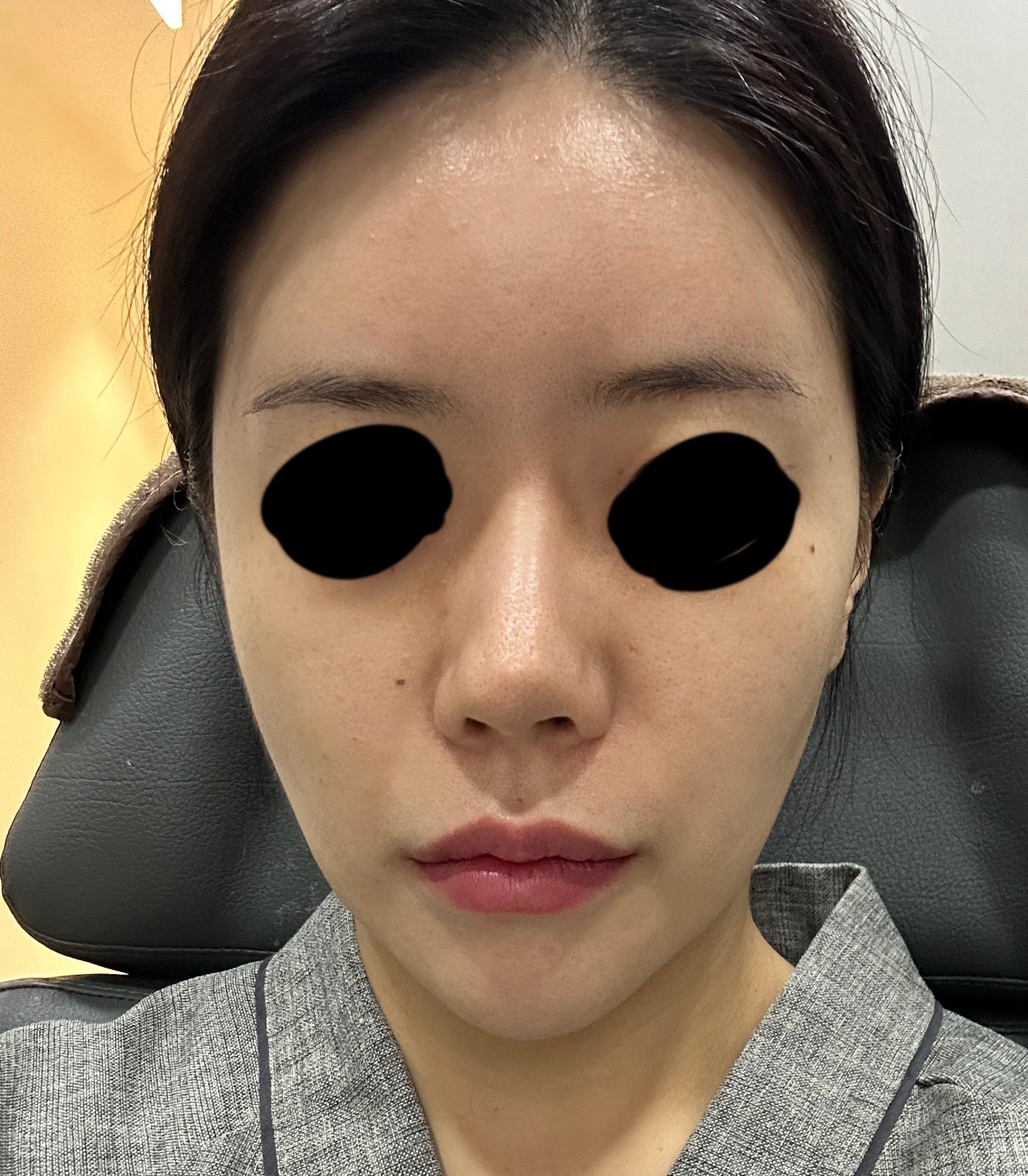 前