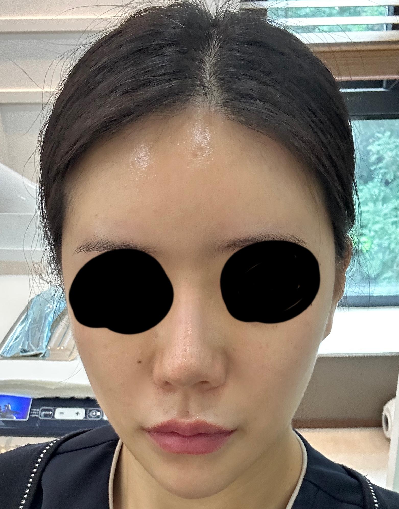 后