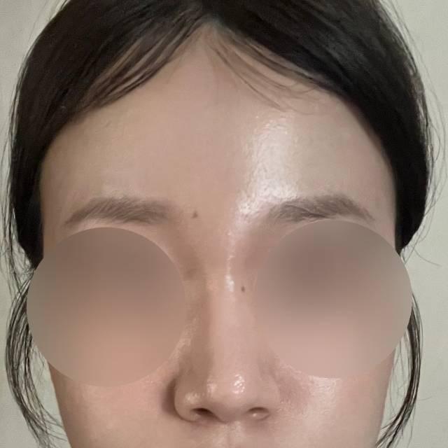 後
