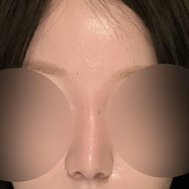 後