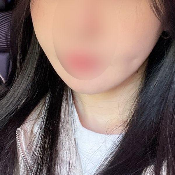 後