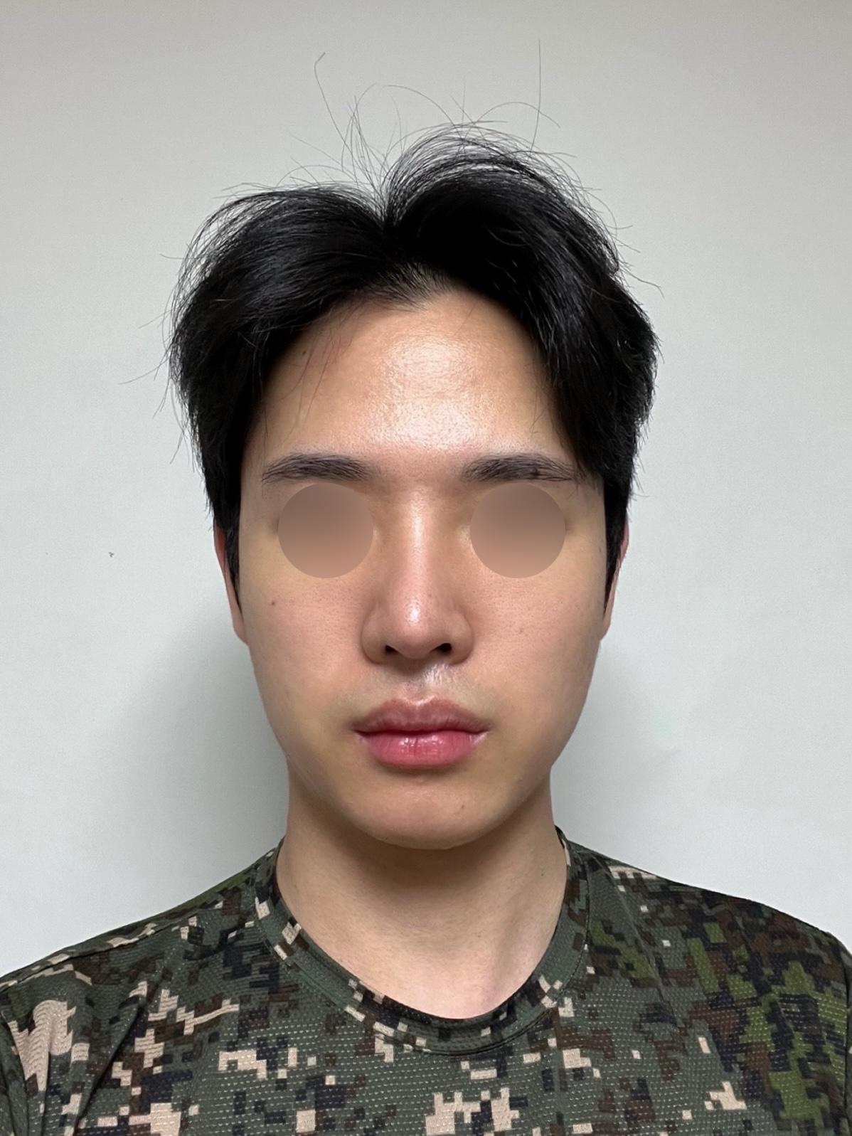 後