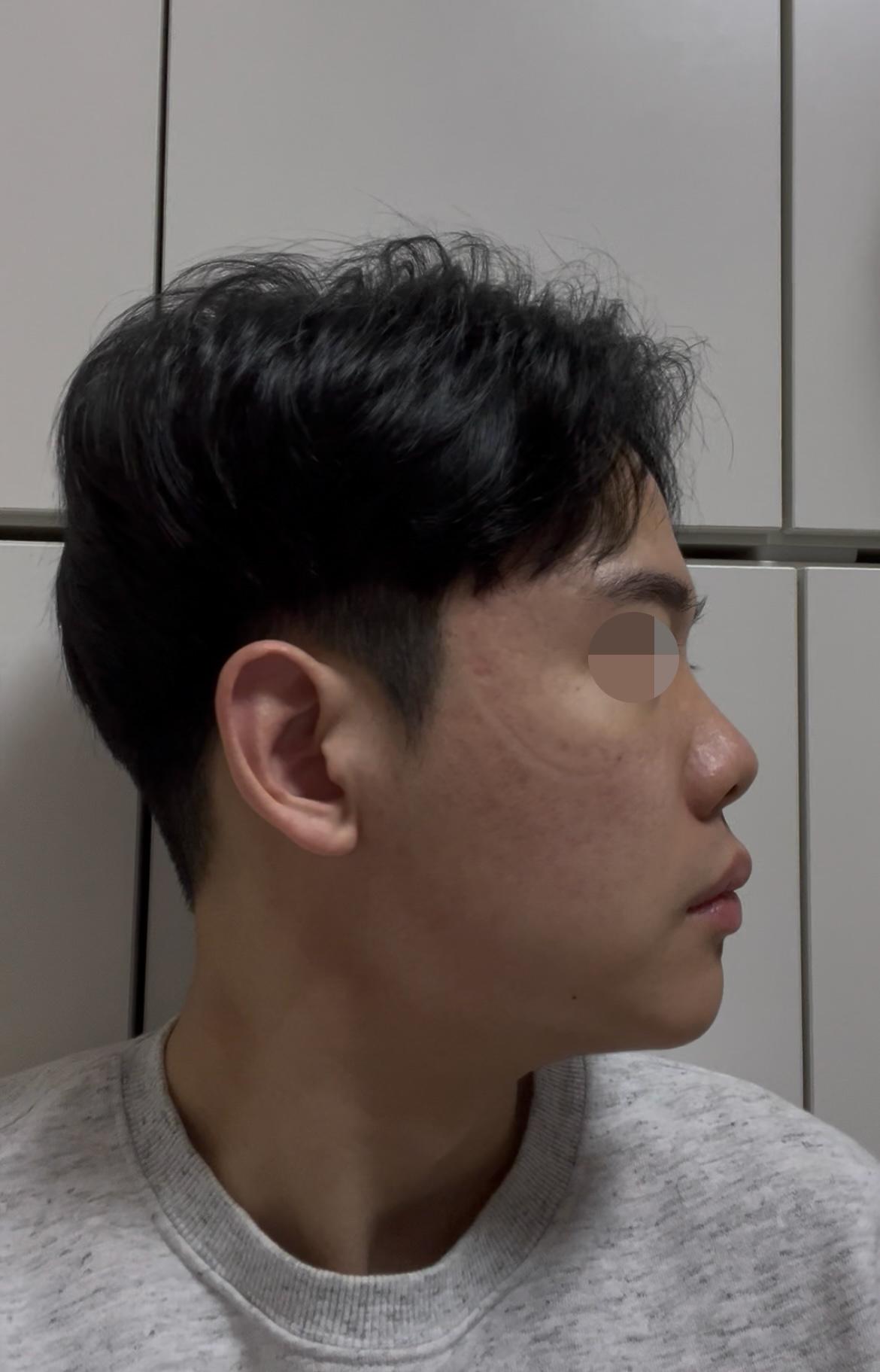 後
