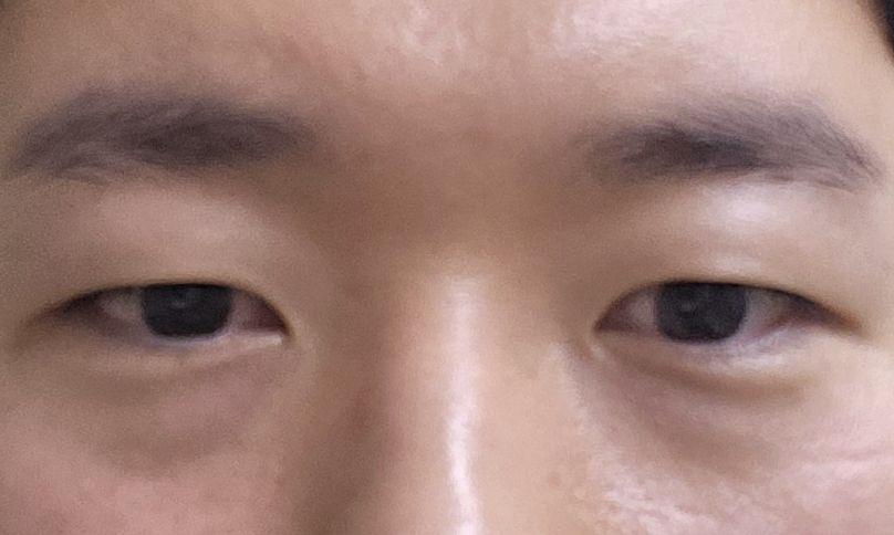 後